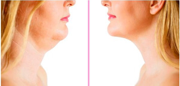 FaceBeauty - Cinta Afinadora de Rosto